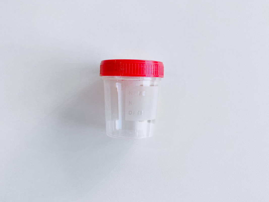 Подготовка к проведению теста на беременность