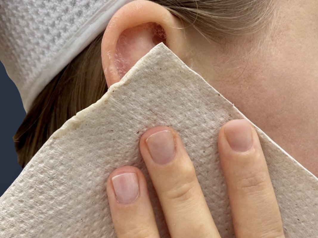 промокните ушную раковину салфеткой