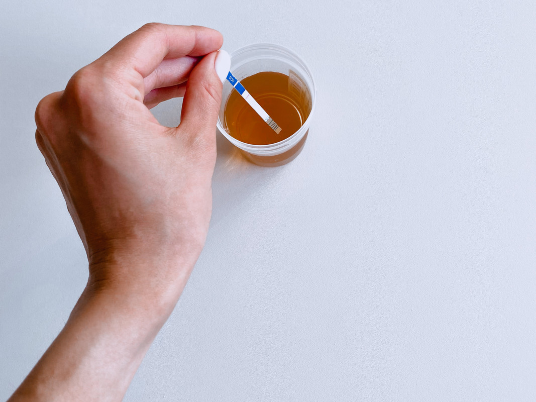 Выполните тест на беременность