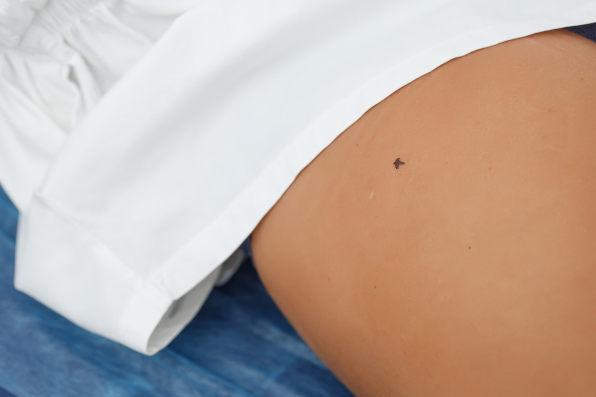 Положення пацієнта під час ін'єкції